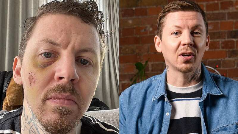 Professor Green nearly died after falling into 