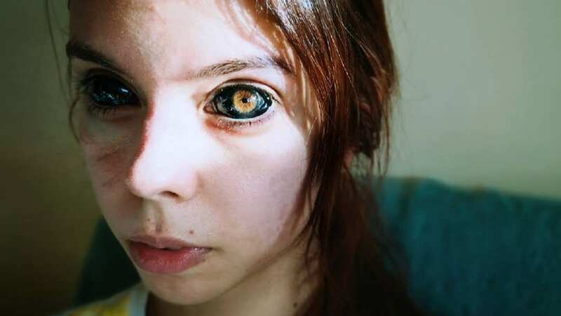 Aleksandra lost her sight after she had her eyeballs unsuccessfully tattooed (Image: Newsflash)
