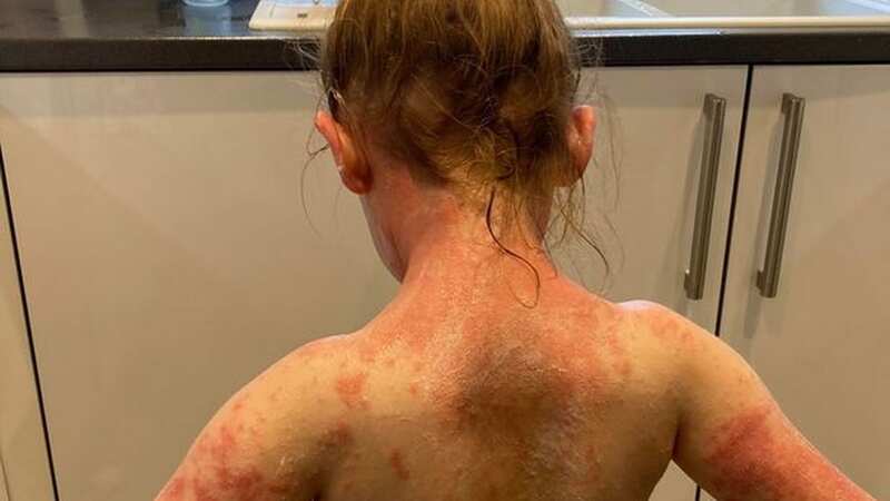 Khloe Rintoul is still suffering with the after effects of Strep A, which she contracted in September (Image: Supplied)