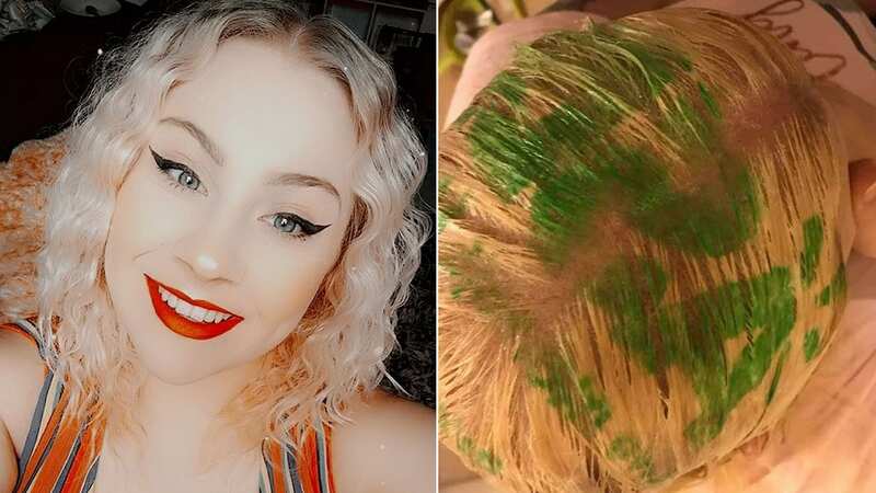 Mum left with Asda logo printed on head after using plastic bag to dye hair