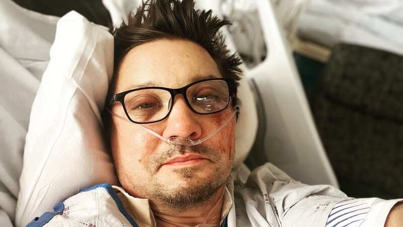 Jeremy Renner shares photo of bruised face and breaks silence after accident