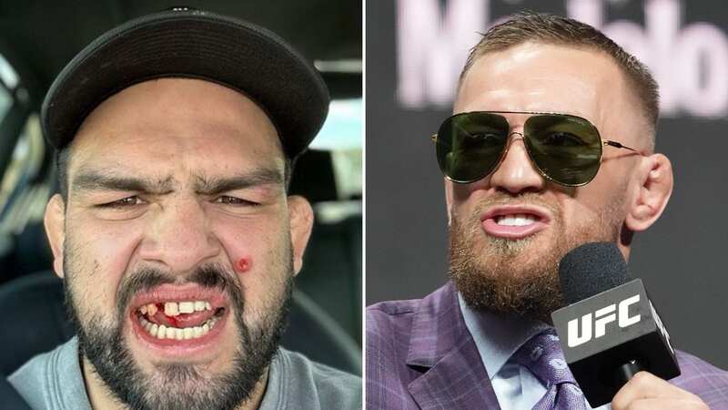 Conor McGregor tells UFC rival to see a doctor about "hole in his face"