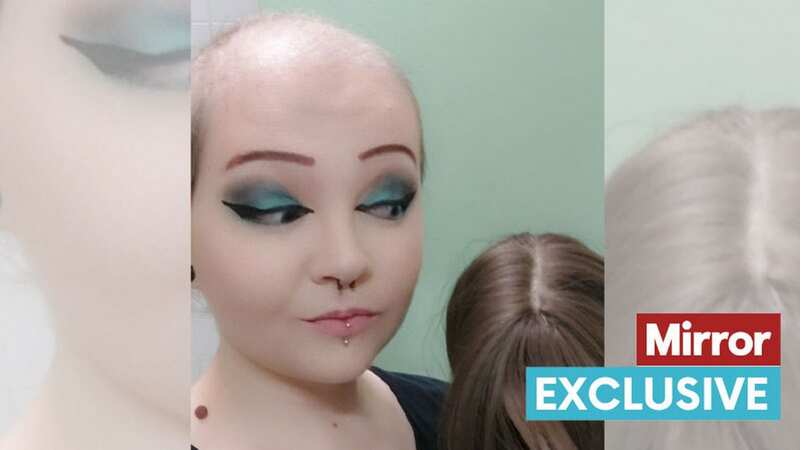 Becka Gaul suffers from Trichotillomania and it has massively affected her life (Image: Becka Gaul/Hook News)
