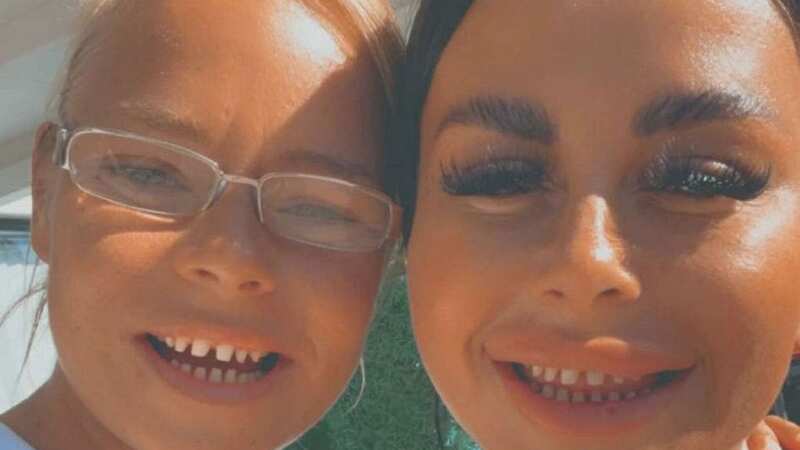 Jade and Kelly Tushingham after having their teeth filed down (Image: Courtesy Jade Tushingham / SWNS)