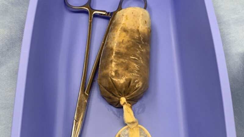 The banana-stuffed condom was removed in hospital (Image: Jam Press)