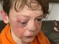 Boy, 12, 'brutally beaten in park by man and teens' is now scared to leave house eiqtidzdiqrtinv