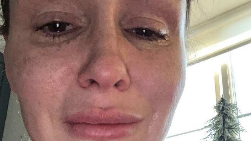 Chanelle Hayes posts tear-soaked selfies as she shares mental health battle