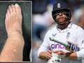 Bairstow "on the right track" for Ashes and World Cup after freak leg break eiqrkidztiddzinv