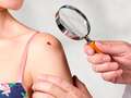 Five common warning signs of cancer in young people from moles to weight changes eiqdikxidrqinv