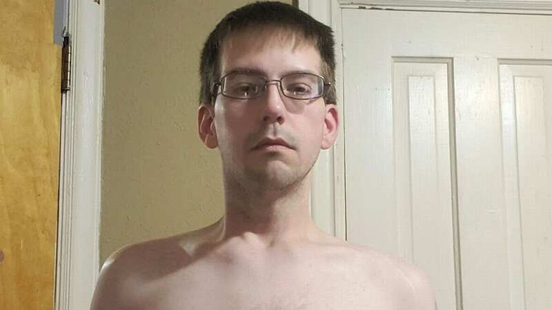 Ryan Tubbs fears he will never find love because of his breasts (Image: Kennedy News and Media)