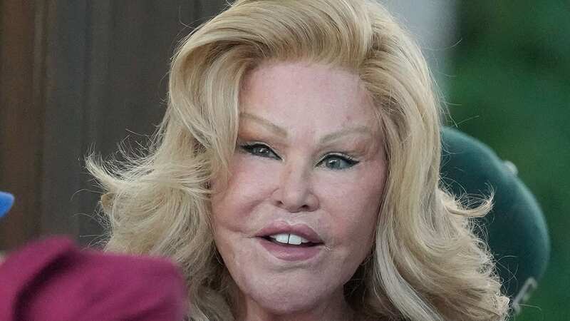 Jocelyn Wildenstein unrecognisable in throwback as she slams surgery rumours