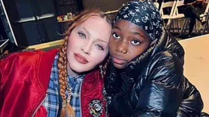 Madonna, 64, shows off very youthful face after surgery confession