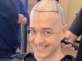 Inside Lee Mead's gruelling 7-hour hair transplant - Turkey procedure to cost eiqrriqzuitrinv