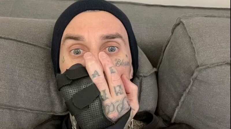 Travis Barker underwent surgery for his injured finger, leading to the band needing to hold off performing until it heals (Image: Travis Barker/Instagram)