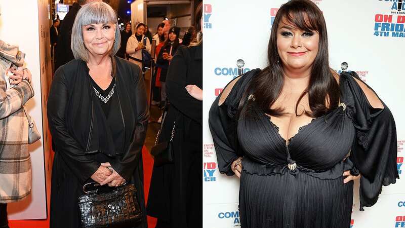 Dawn French has opened up about her weight loss journey over the years