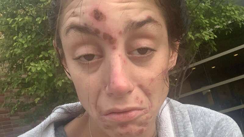 Cara Tatarelli first tried heroin and crack at the age of 17 (Image: Supplied)