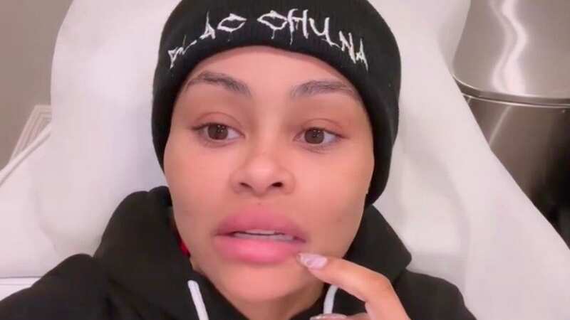 Blac Chyna warns over fillers as she looked 