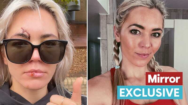 Danni Menzies feared career was over after terrifying moped incident