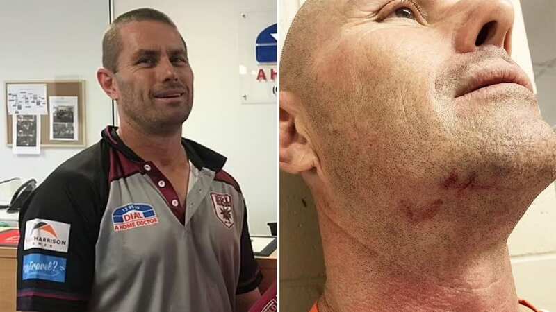 Brian Roper shows his injuries from the incident