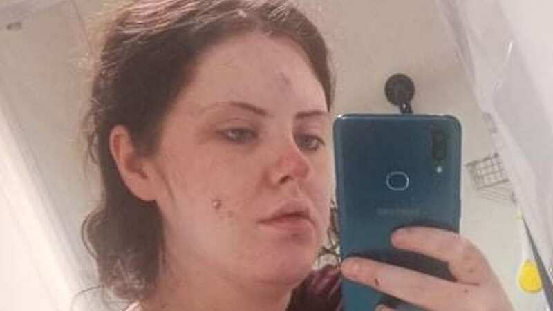 Amy MacFarlane, 25, has bravely told how she was held hostage by her ex-partner (Image: Focus Features)