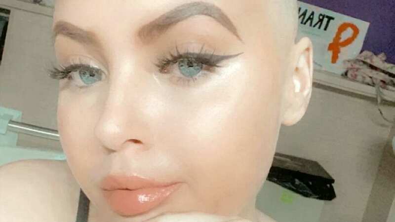 Chloe-Leigh Todd after losing her hair (Image: Chloe Todd / SWNS)