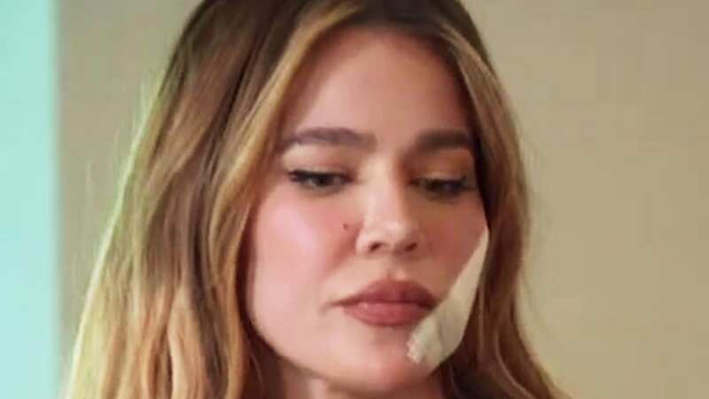 Khloe Kardashian shows off huge facial scar as she reveals cancer scare