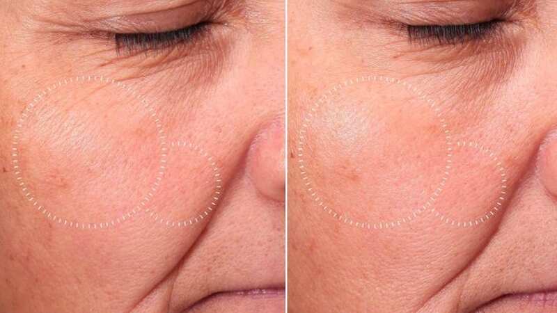 The toner has been clinically proven to work in just 4 weeks!