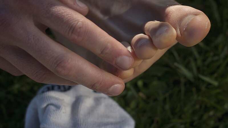 Symptoms can show up on people