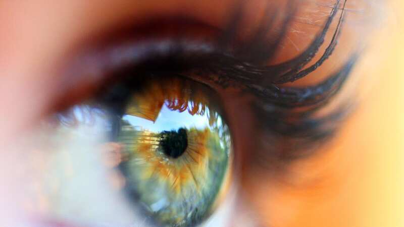 Check around your eyes for signs of high cholesterol (Image: Getty Images)
