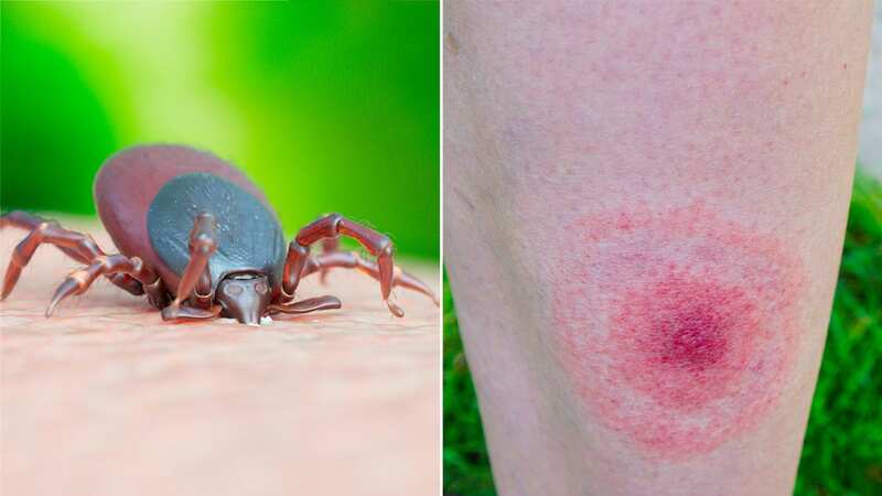 Ticks are normally transported via humans and animals (Image: Getty Images/Science Photo Library RF)
