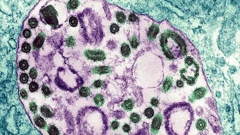 Nine deadly infections that could spark a pandemic - but one is missing