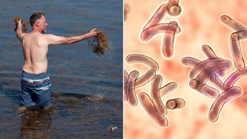 Beachgoers are being warned of "leaky gut syndrome" (Image: Getty Images)