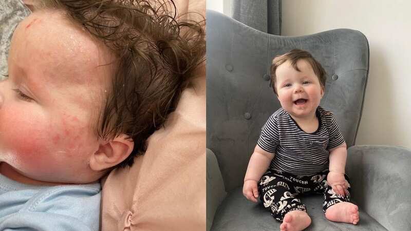 "I saw an article showing a baby that had clear skin thanks to Balmonds skin salvation so gave it a try not expecting much and it literally cleared his eczema overnight. He is now 7 months old and we wouldn’t be without it." (Image: Abbie Trevelyn)