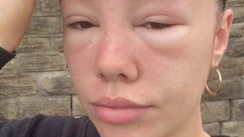 Orla