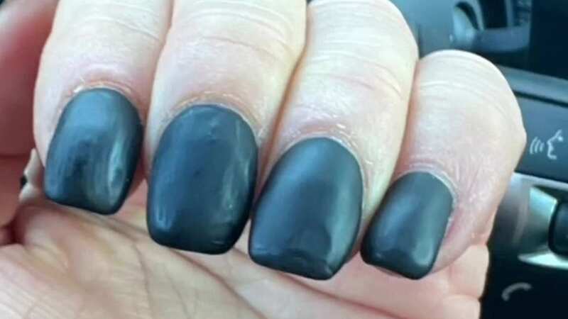 Manicure fail leaves woman looking like she dunked her fingers in 