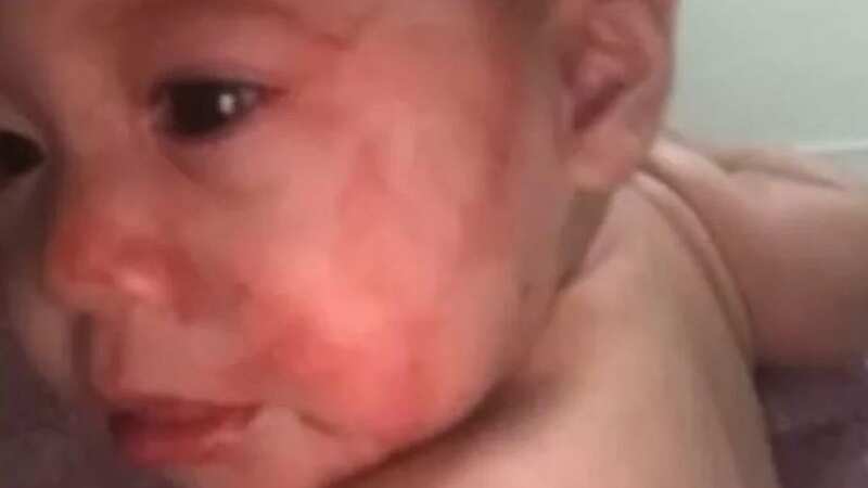 Baby Satuala was quickly rushed to hospital by her panicked mother (Image: 7News)