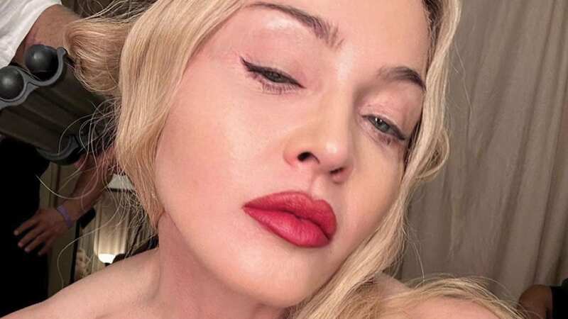 Madonna
