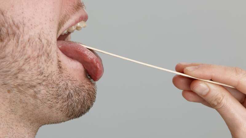 One unusual symptom of a B12 deficiency includes changes to your tongue - which could appear swollen or more inflamed and red (Image: Getty Images)