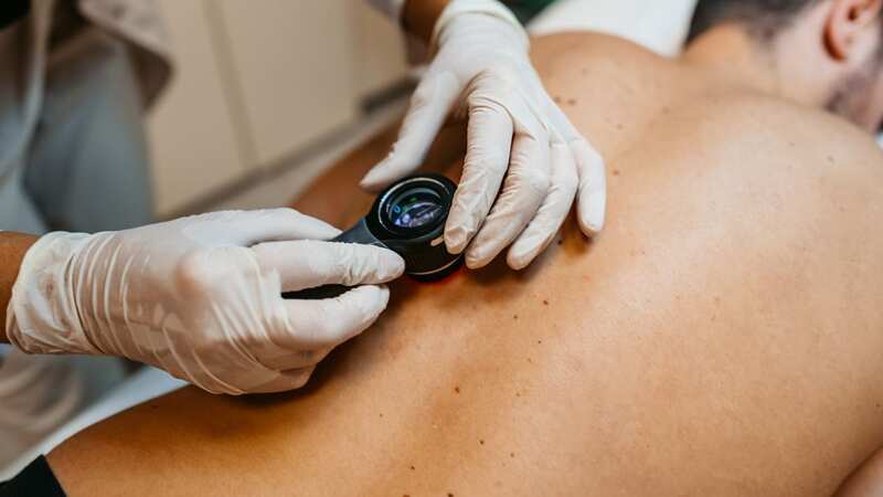 Skin cancer cases have soared (Image: Getty Images)