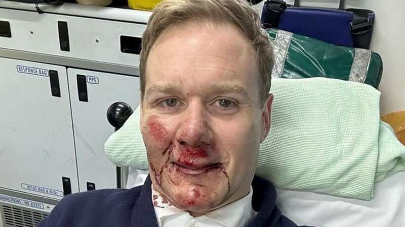 Dan Walker miraculously avoided serious injury in the crash