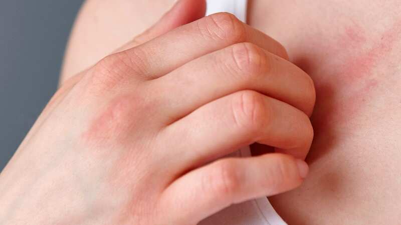 One in three adults will experience the virus (stock photo) (Image: Getty Images/Cultura RF)