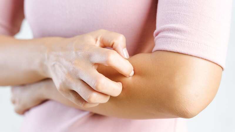 Killer virus sweeping through Europe includes rash symptoms in three key areas