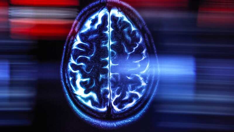 There are two drug which could slow the disease (Image: Getty Images/Science Photo Library RF)