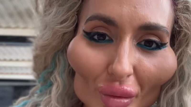 The Ukrainian model has yet again gone under the knife, sharing her latest boob job, whilst holding her old implants (Image: Anastasiia / Instagram)