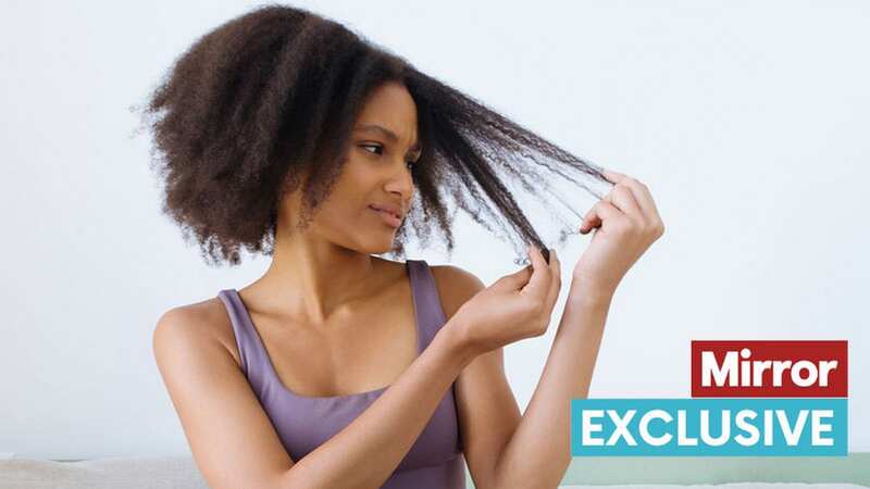 Black men and women are predisposed to certain types of hair loss conditions, such as traction alopecia and CCCA (stock photo) (Image: Getty Images)