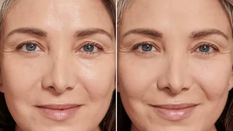 Many beauty fans have been raving about their results after trying the product (Image: Laura Mercier)