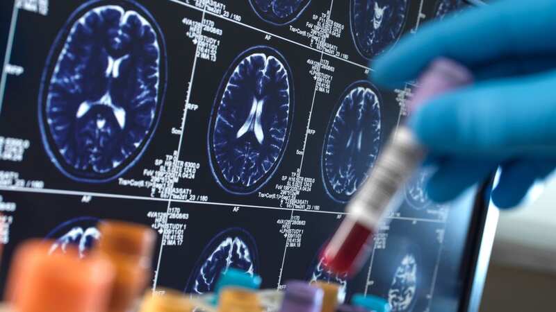Two little-known dementia symptoms you could spot in loved ones at home