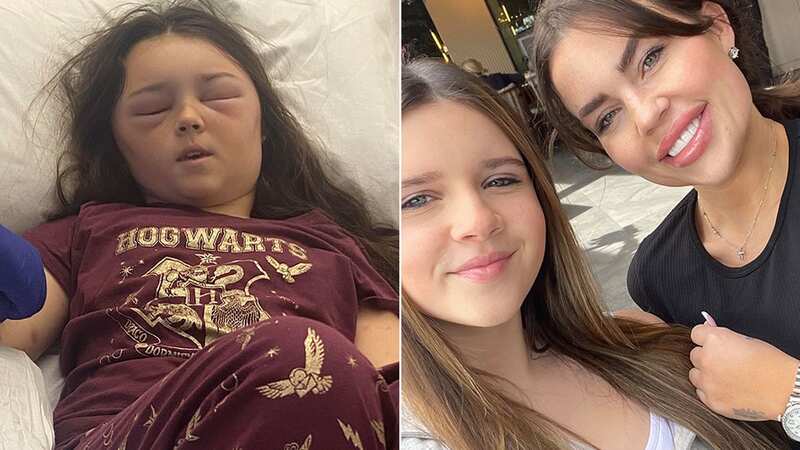 Honey Barton, then 11, visited a walk-in centre after noticing unusual swelling on her hands and feet