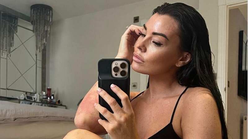 Jess Wright shows psoriasis in candid photo and declares 