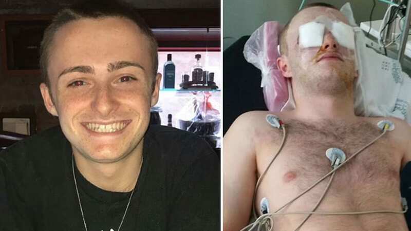 Dillon Connery, who was blinded aged 18 after paint bag was blasted into his face